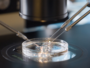 IVF behandeling (In Vitro Fertilisatie)